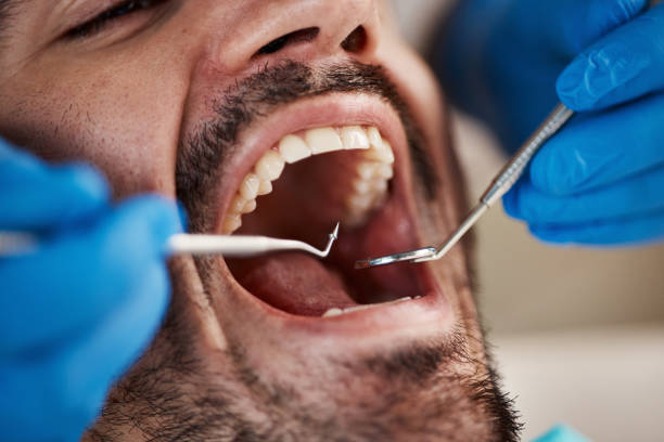 Best Weekend Emergency Dentist in Rocky Mount, VA